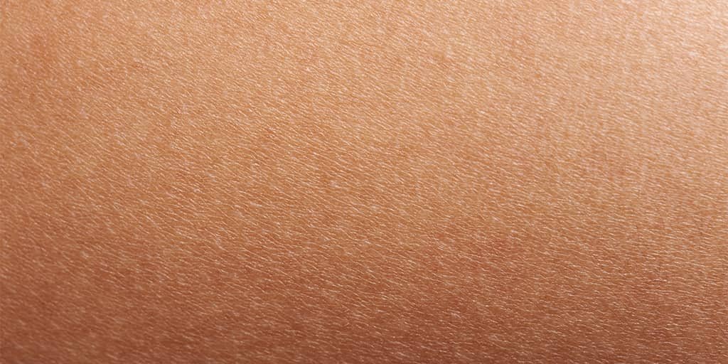 Dermatita atopica sau doar piele uscata