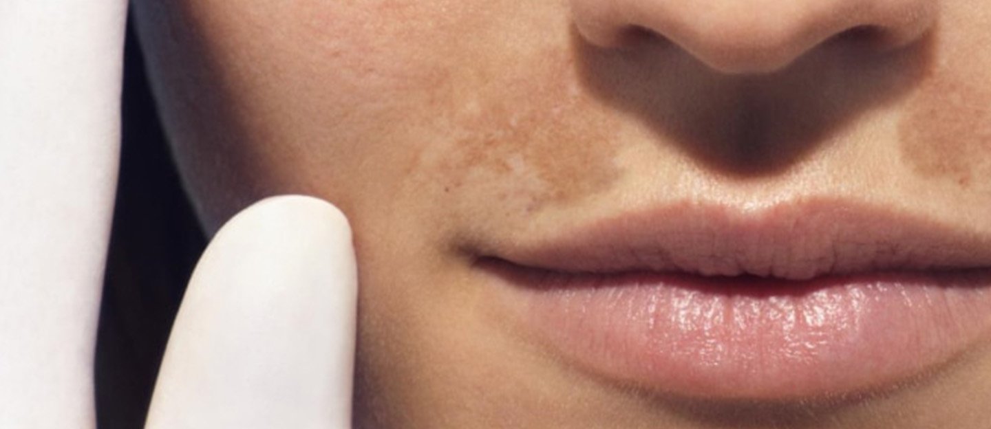 Beneficii Vitamina B3