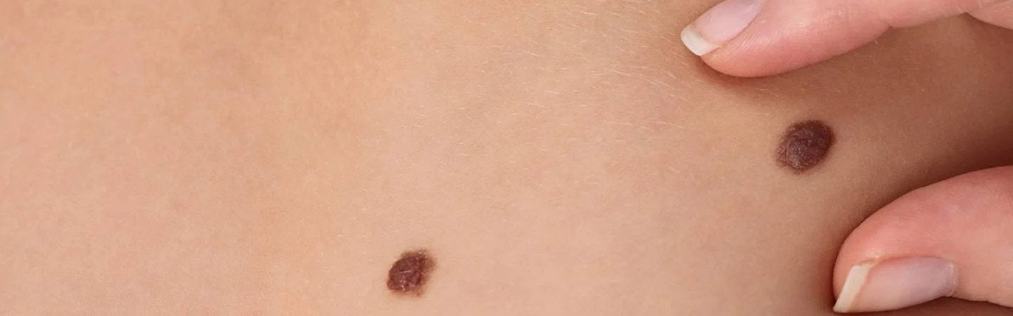 Programari gratuite la medcul dermatolog