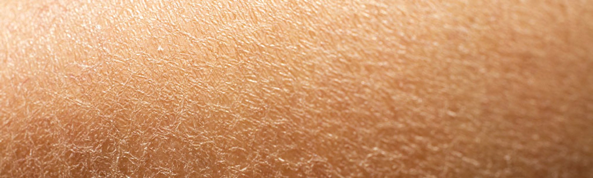 Laroche-Posay Romania articles sensitive skin 