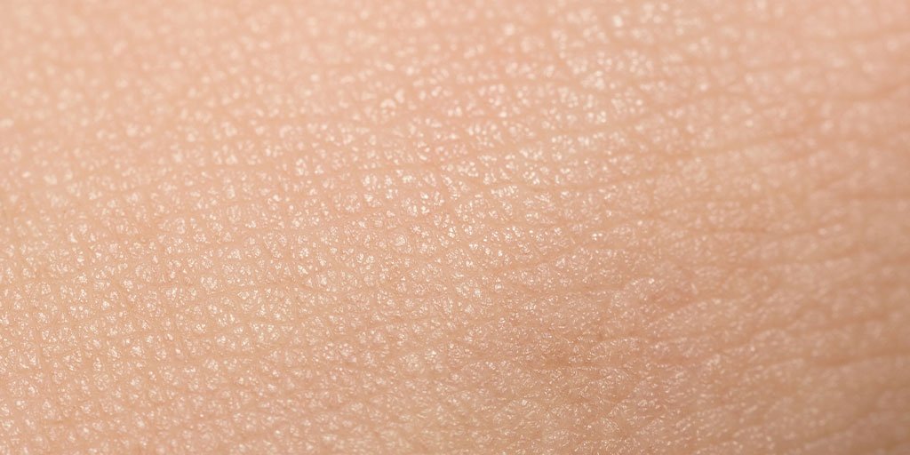 Melasma sau cloasma si pete pe fata in sarcina