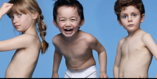 Ce este dermatita atopica