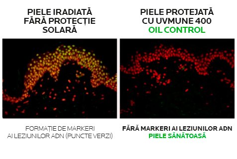 Piele iradiata fara protectie solara si piele protejata cu UVMUNE 400 Oil Control
