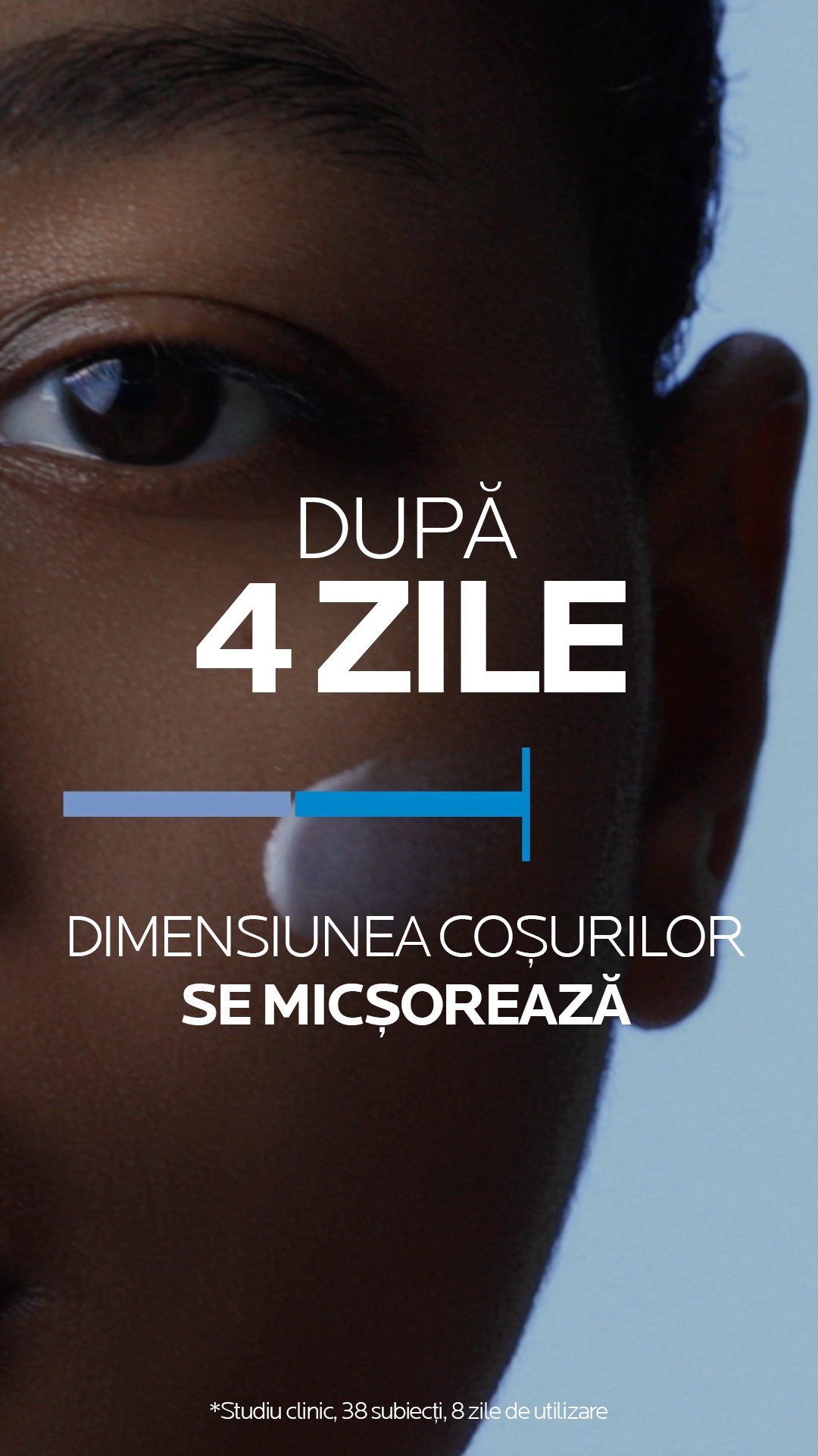 lrp-landing-Effaclar-Duo+-2022-sitecore-website-mosaic-efficacy_2