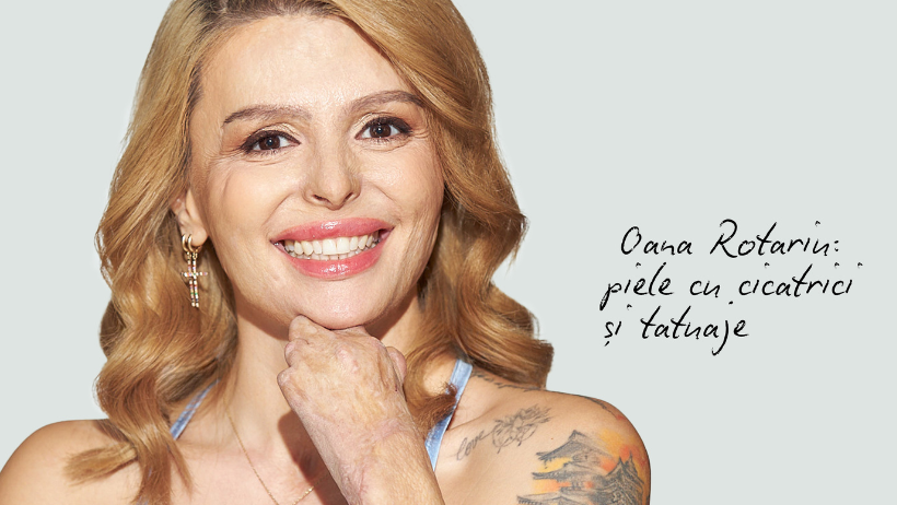 Oana Rotariu piele cu cicatrici si tatuaje